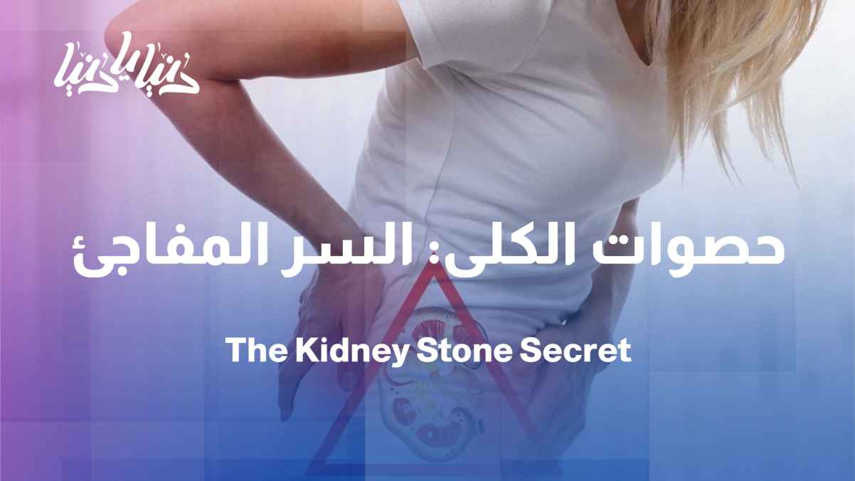 Kidney stones: Why do they appear suddenly even though they form slowly? Ask a specialist.