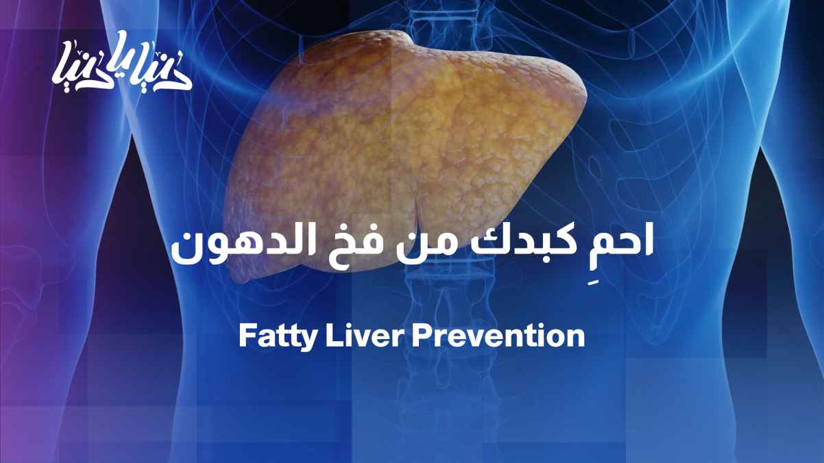 Between diet and inactivity... how does fatty liver develop?