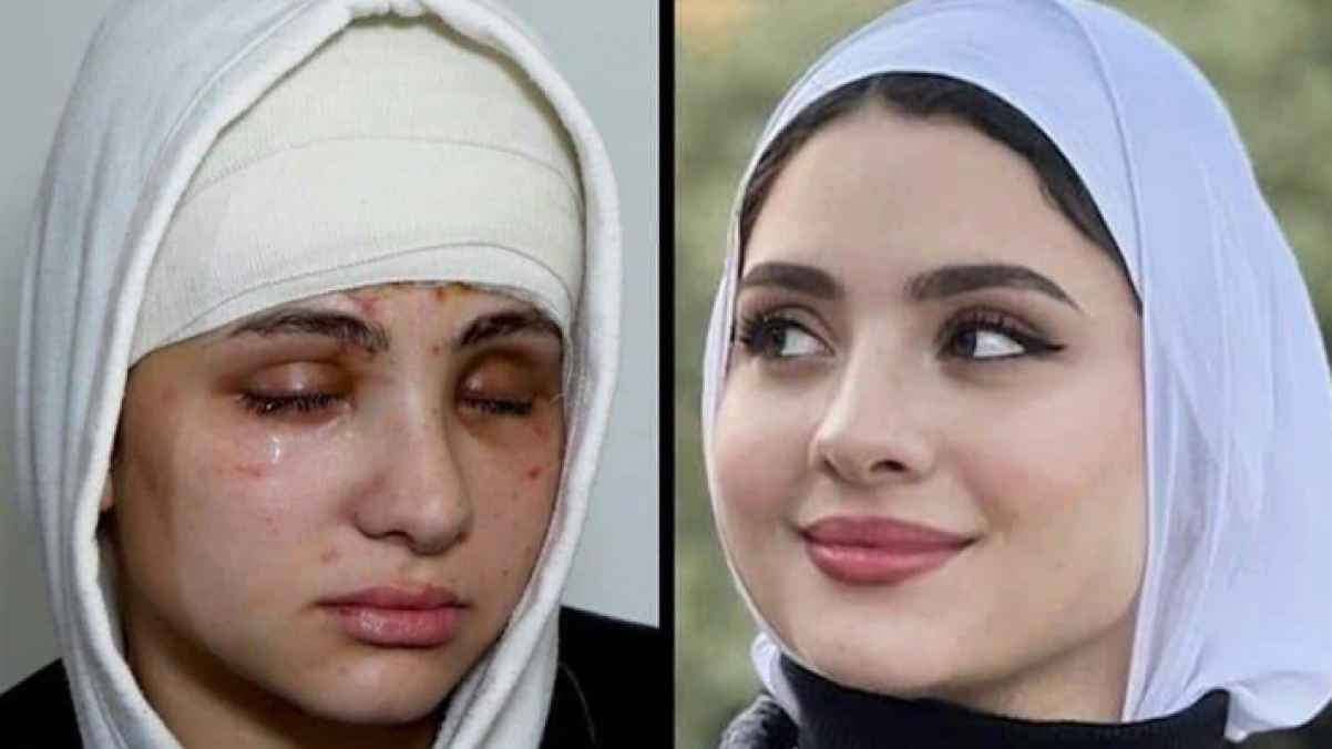 صديقة سارة محمد تناشد بنقل البلوغر إلى الخارج بعد فقدانها بصرها