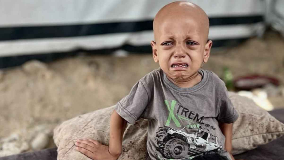 رحل وبقي صوته.. عبد الله أبو زرقة يهز ضمير العالم من قبره - فيديو