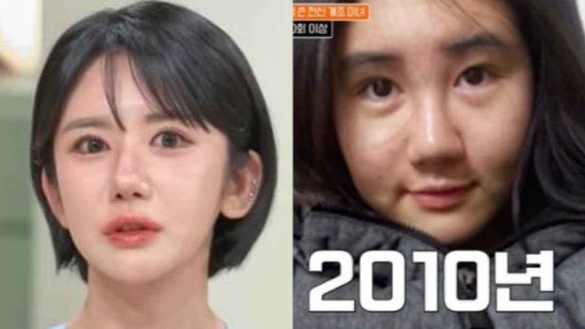 كورية تنفق أكثر من 210 آلاف دولار على 400 عملية تجميل خلال 15 عامًا!