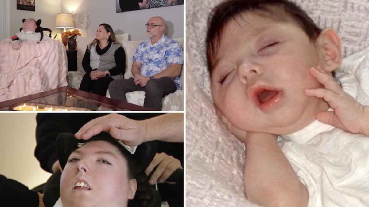 شابة أمريكية تعيش 20 عاما رغم توقعات بوفاتها المبكرة