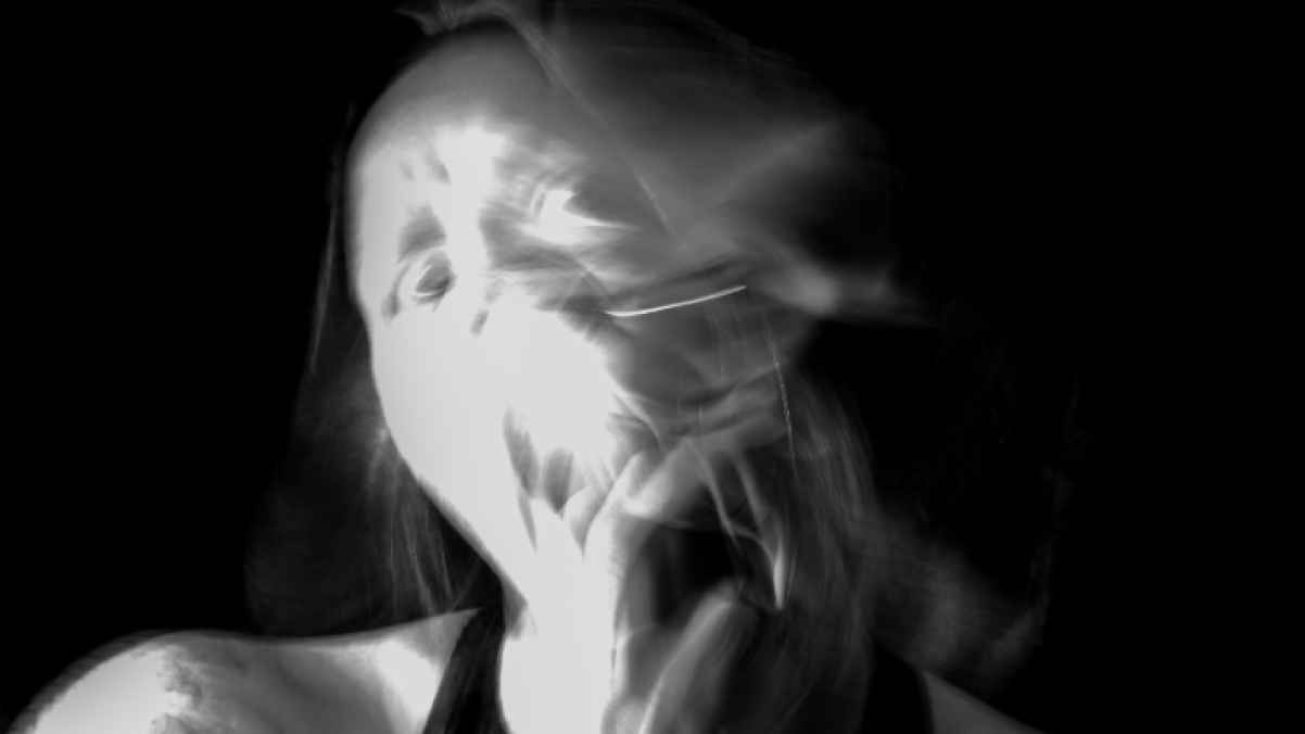 تشوهت بحروق.. هجم عليها بسائل حمضي أثناء مشيها في الشارع 