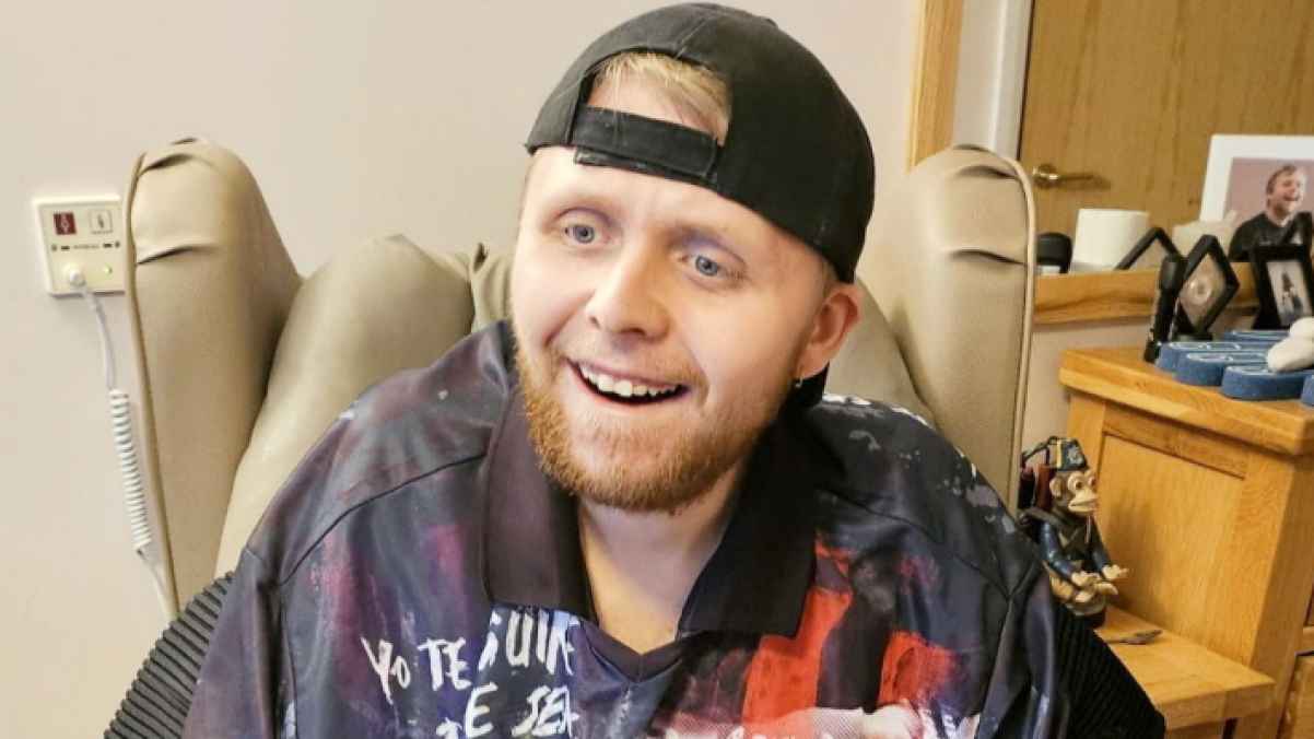 Youngest dementia patient dies in rare case at 24