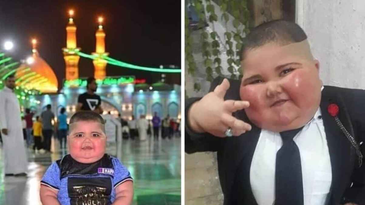 وفاة الطفل العراقي "حسوني" واللوم يطال أسرته لهذه الأسباب