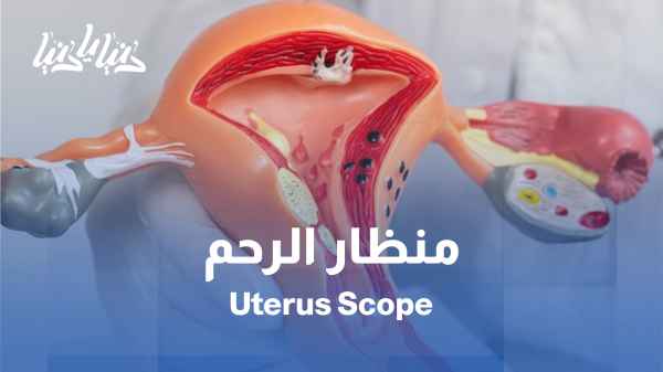 كيف تساعد جراحة منظار الرحم في تشخيص مشاكل الرحم وتأثيرها على الحمل؟