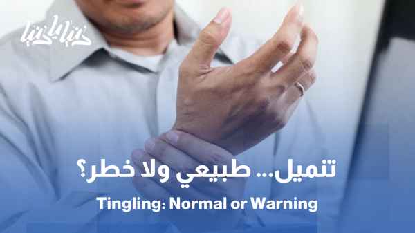 تنميل الأطراف .. عرض بسيط ولا إنذار لمشكلة أكبر؟ الجواب عند الطبيب