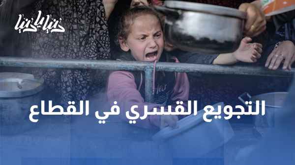 Forced starvation is a crime practiced by the occupation in the Gaza Strip.