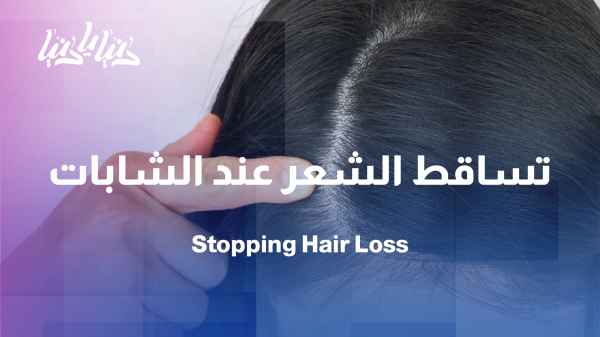Study: Why is hair loss increasing among young women? Experts answer.