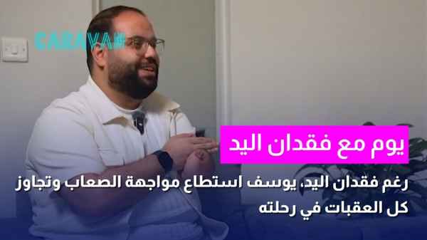 يوم مع فقدان اليد