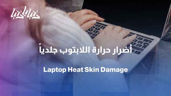 Laptop Heat: When Does It Become a Skin Problem?