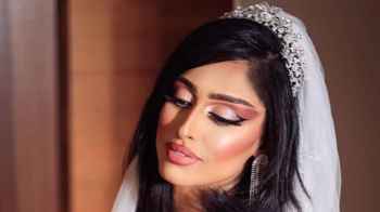 فنانة كويتية تنجو من الموت بعد طعنها من قبل عصابة- صورة