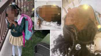 They tore off her scalp and tried to assault her—Two American boys attack a five-year-old girl!