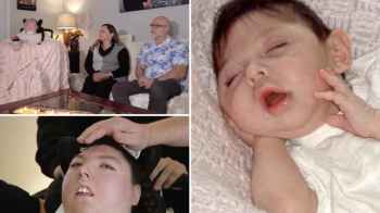 شابة أمريكية تعيش 20 عاما رغم توقعات بوفاتها المبكرة