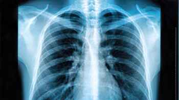 Woman agrees to collude with boyfriend against insurance after bone injury